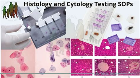 5 Essential Tasks Of A Cytology Prep Tech