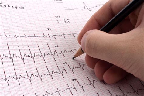 5 Ways Ekg Techs Thrive In California