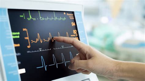 5 Ways To Hire Top Ekg Technicians