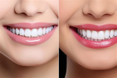 7 Ways Hi-Tech Dental Care Transforms Your Smile