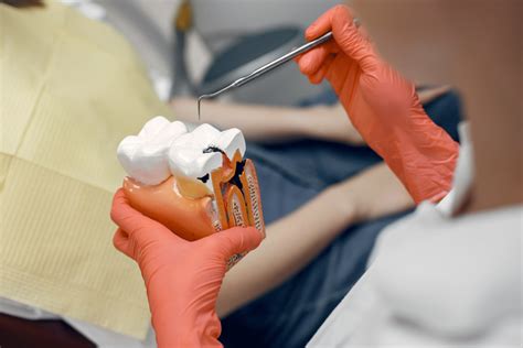 High Tech Root Canal Treatment In San Diego