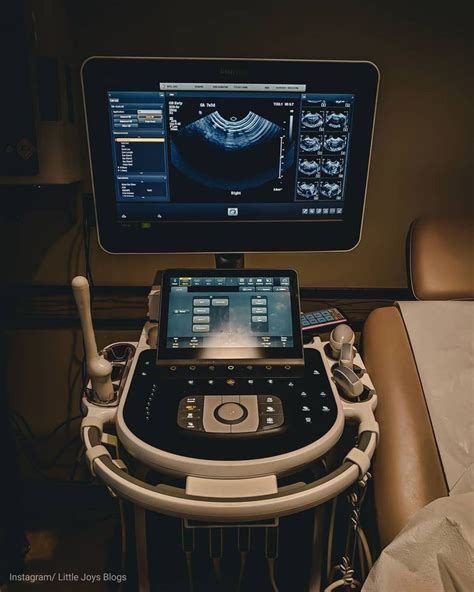 Pima Ultrasound Tech: Diagnostic Imaging Expertise