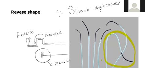 Resent Kones Tech Explained Simply