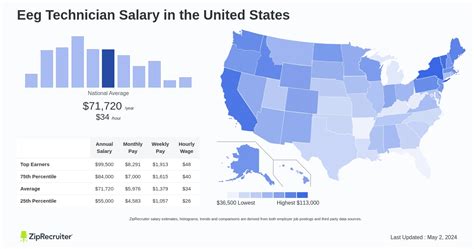 Traveling Eeg Tech Salary Guide