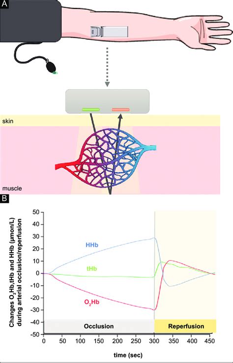 Understanding Myovy: Muscle Oxygenation And Performance Tracking